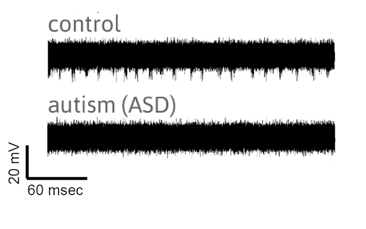 Neuronal activity of control subjects and people with autism