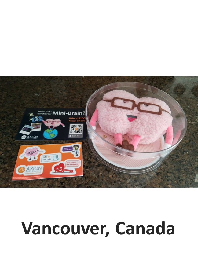 Mini-brain in Vancouver Canada