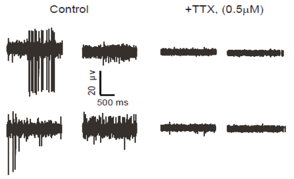 Native neural function was recorded and responses to drug treatments shown