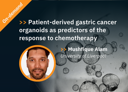 On-demand webinar