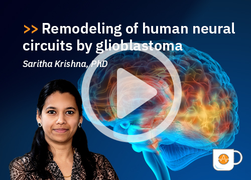 Remodeling of human neural circuits by glioblastoma, Dr. Krishna CBW