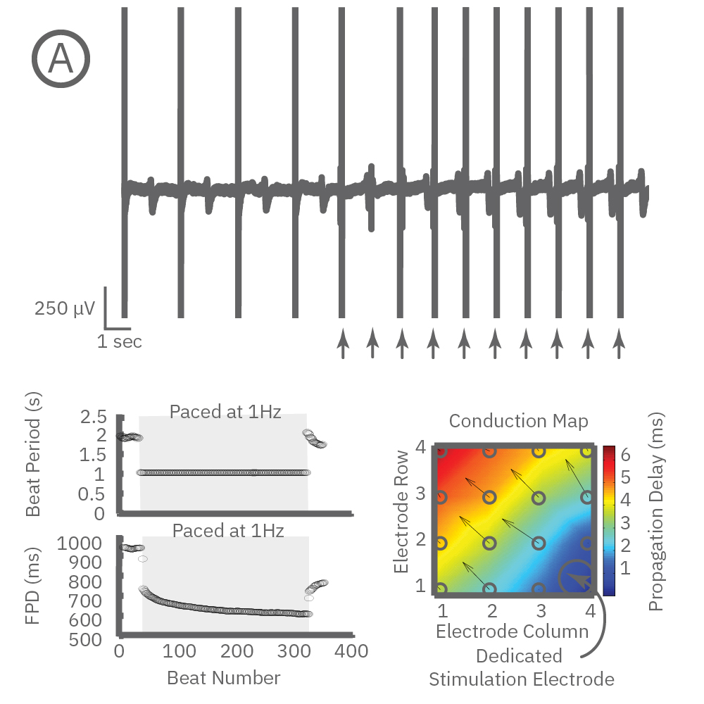 Cardiac pacing sets a desired beat by optical or electrical pacing