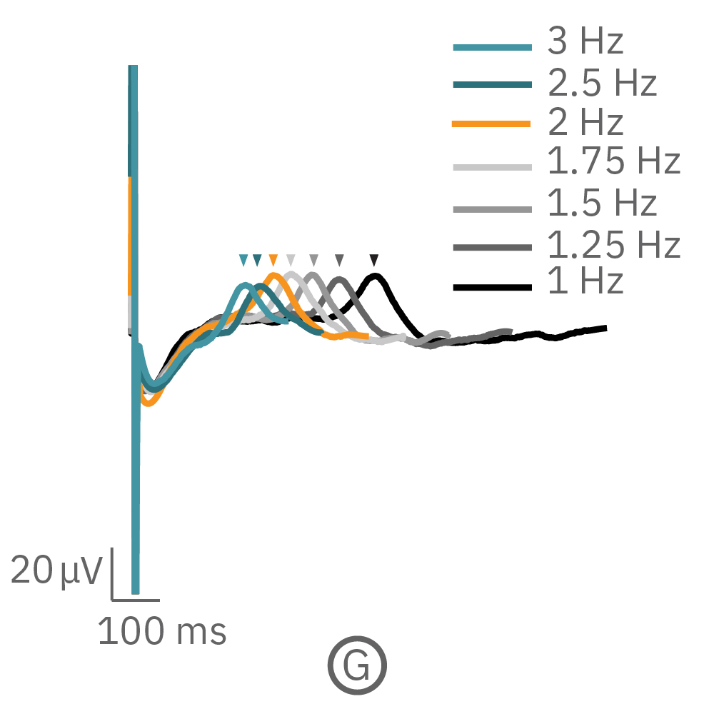 The field potential duration adapted with each sequential beat rate increase up to 3 Hz