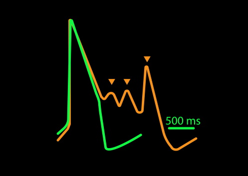 Cardiotoxicity and Safety Assays