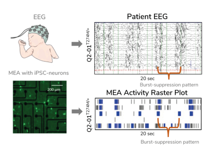 EEG correlation to MEA activity of neurons