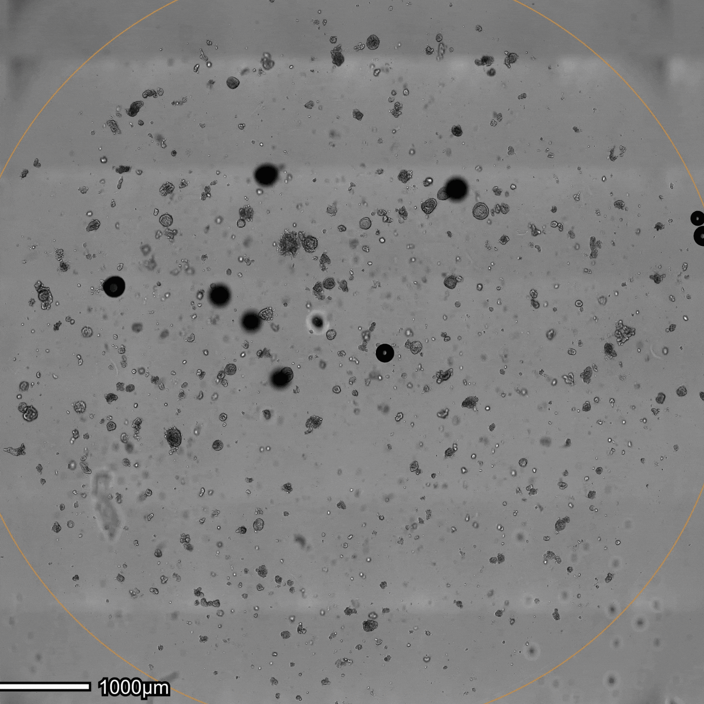 Hepatic organoid detection with Omni Imaging