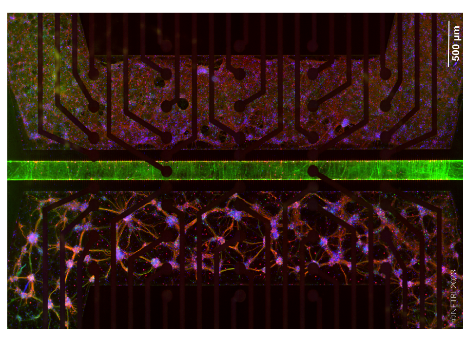 Hippocampal Cortical Brain-on-a-chip view