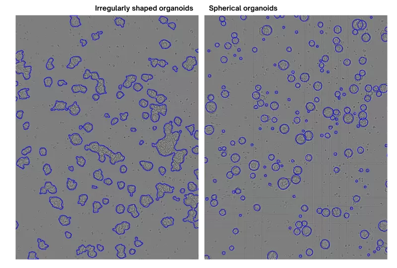 Irregular and Spherical organoids