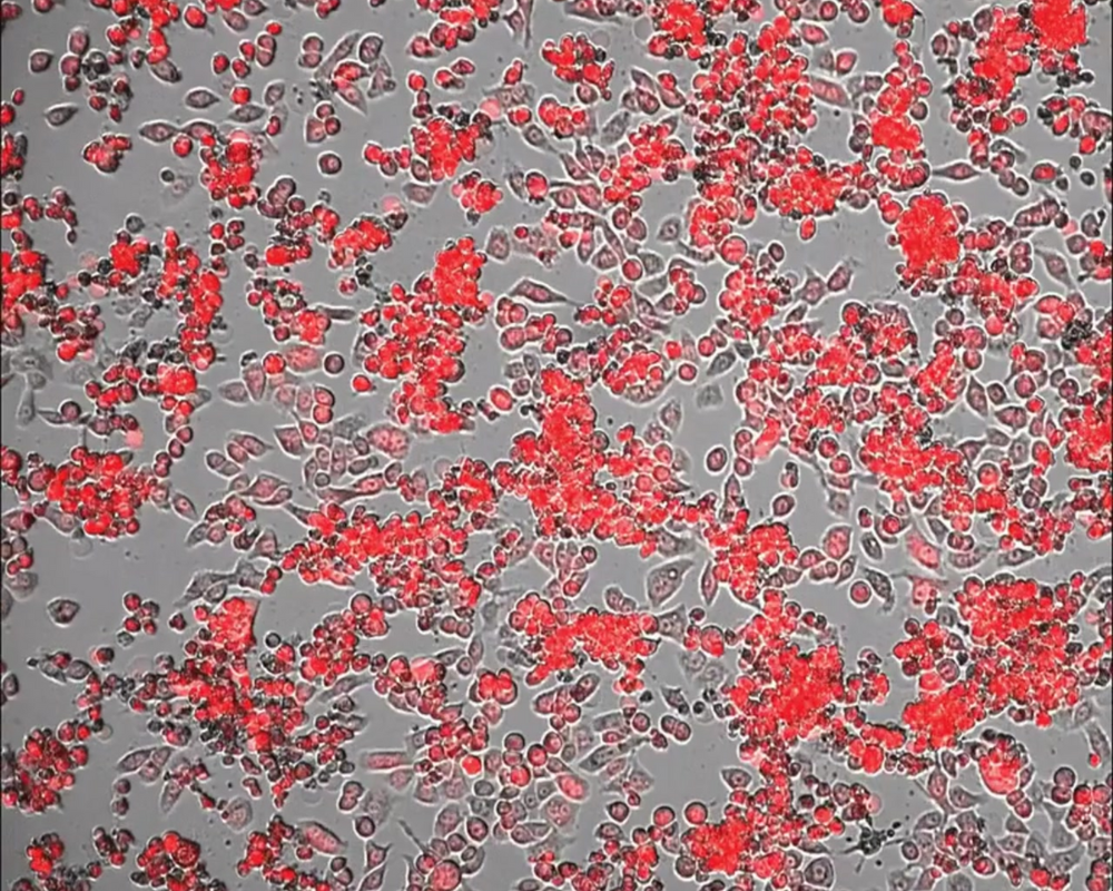 Immuno-Oncology Card