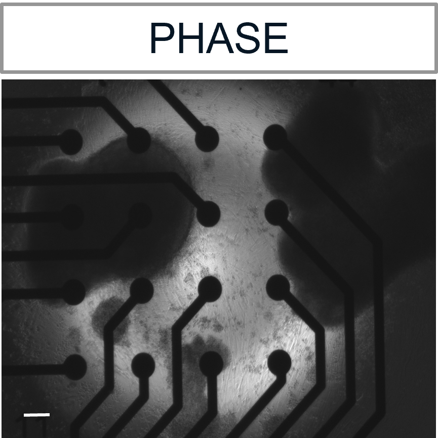 Channel rhodopsin (ChR2) expressing motor neurons were cocultured with skeletal myotubes