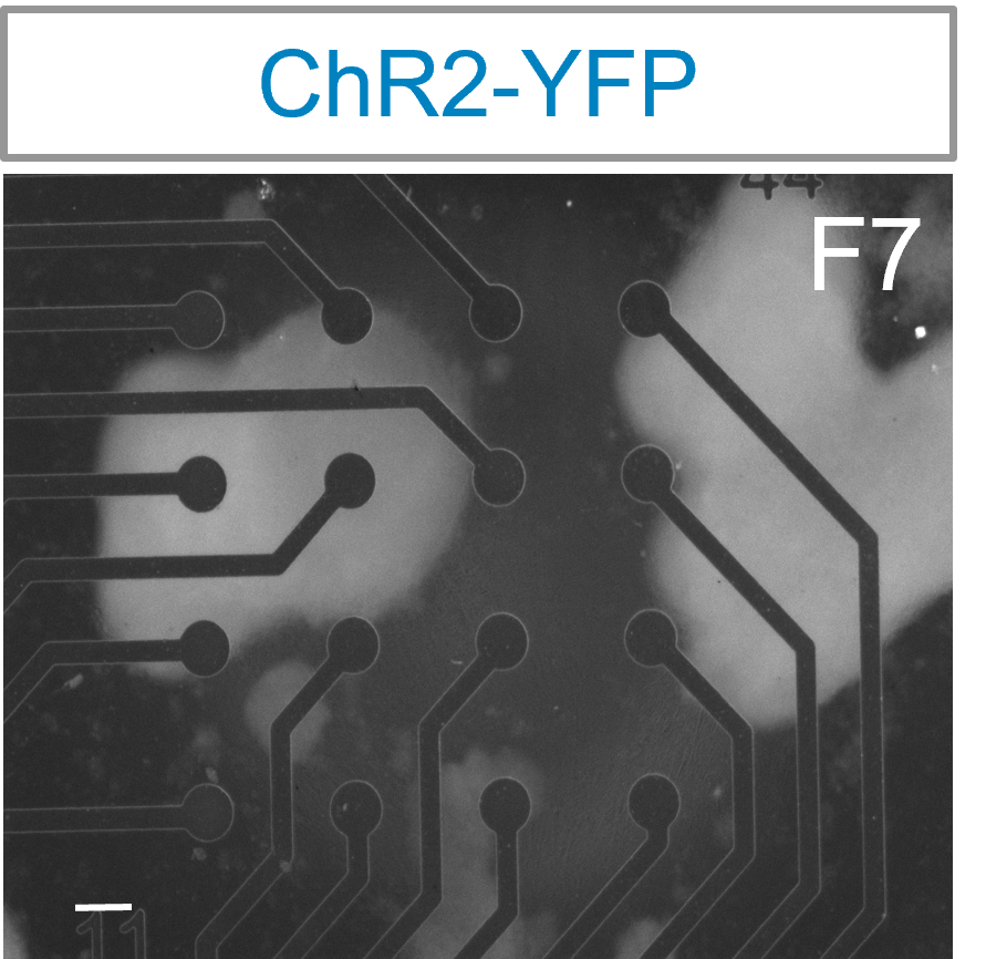 Channel rhodopsin (ChR2) expressing motor neurons were cocultured with skeletal myotubes