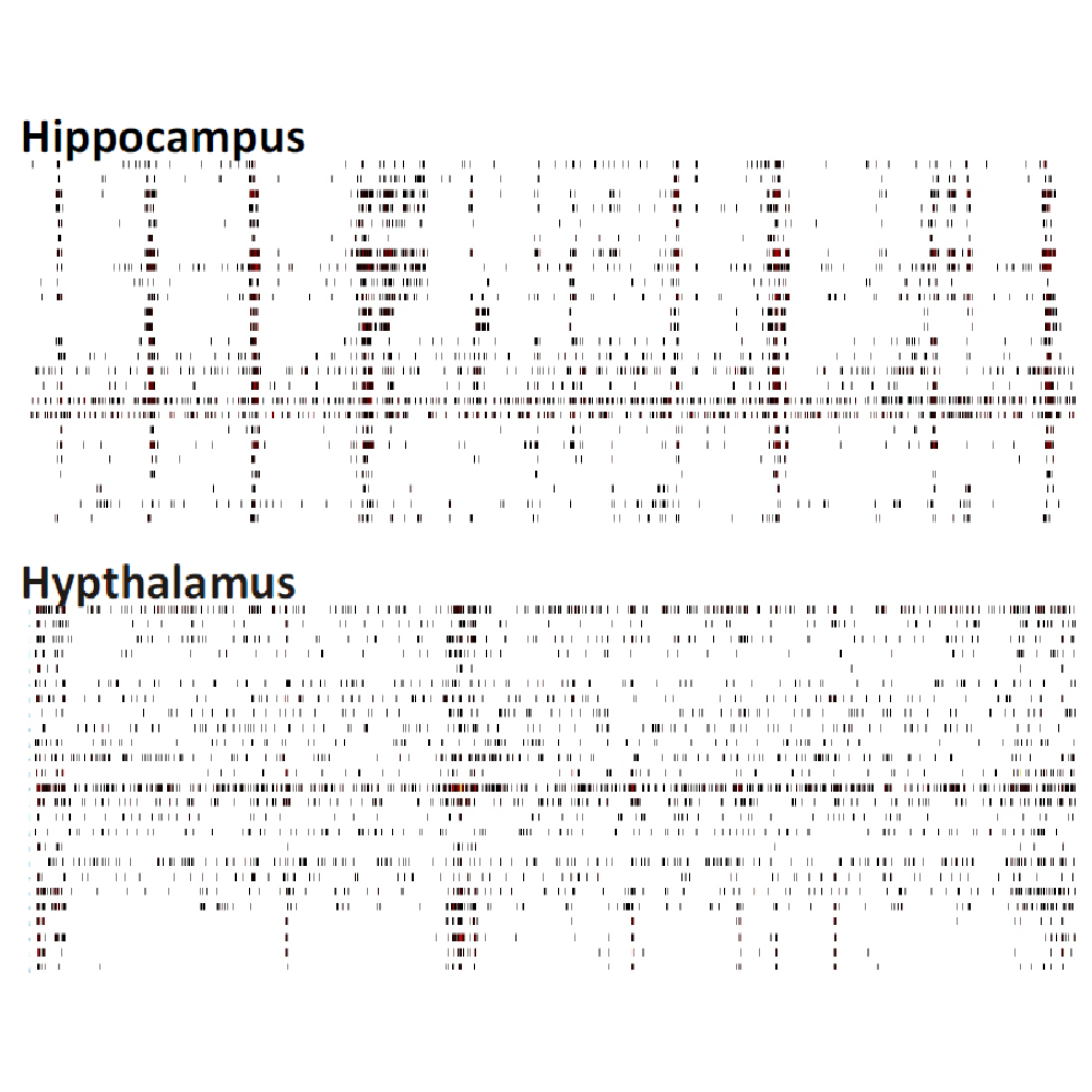 Neuro characterization of brain region