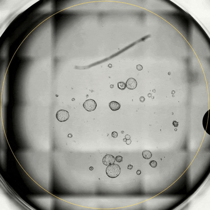 Continuous insights of your organoid growth with Omni Imaging Platform