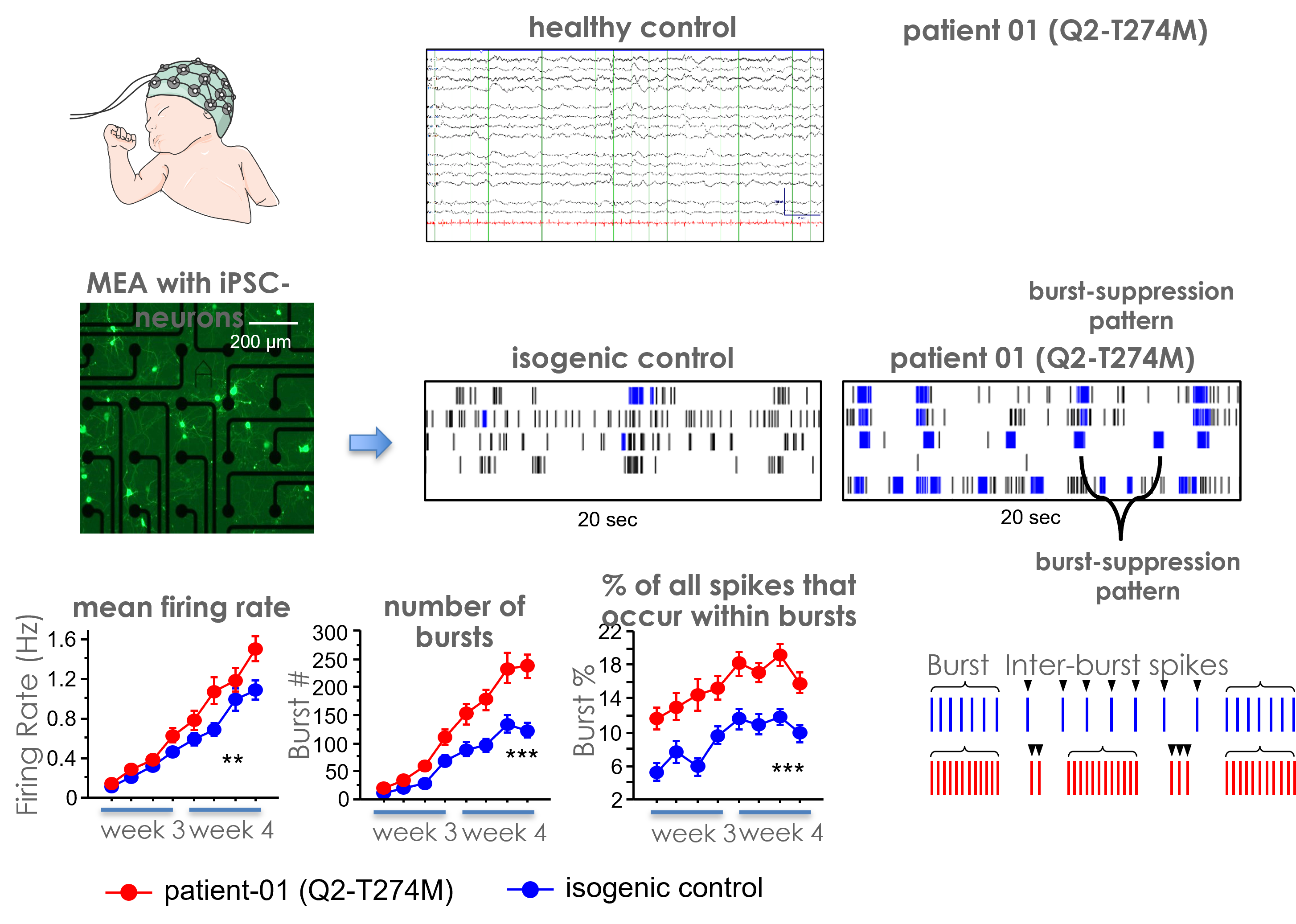 Analysis of a stem cell-based model of epilepsy