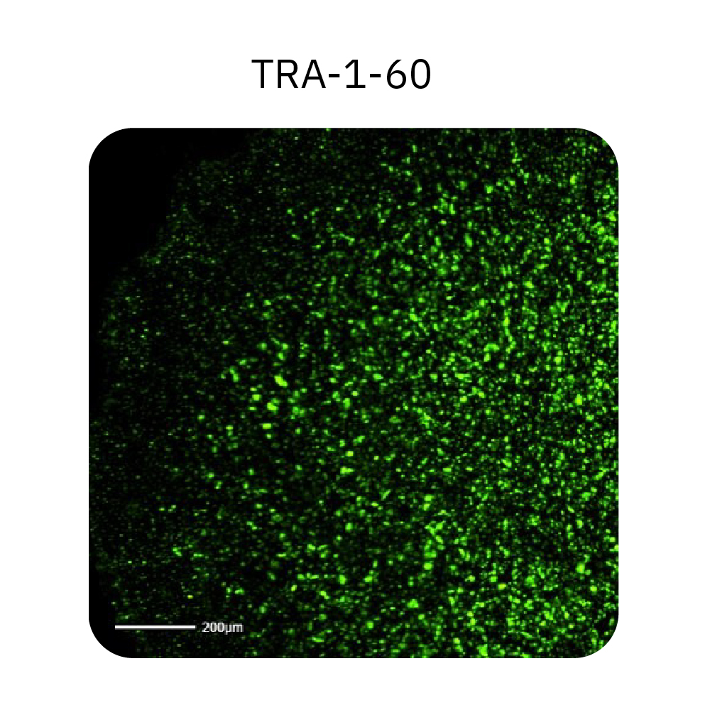 Human iPSC colonies were stained with a pluripotent marker, TRA-1-60, and imaged in the green fluorescence channel on the Omni platform 