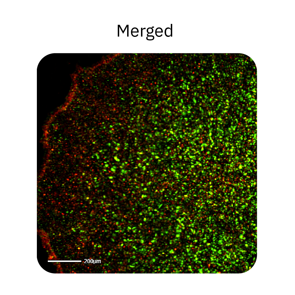 Human iPSC colonies were stained with a pluripotent marker, TRA-1-60, and imaged in the green fluorescence channel on the Omni platform 