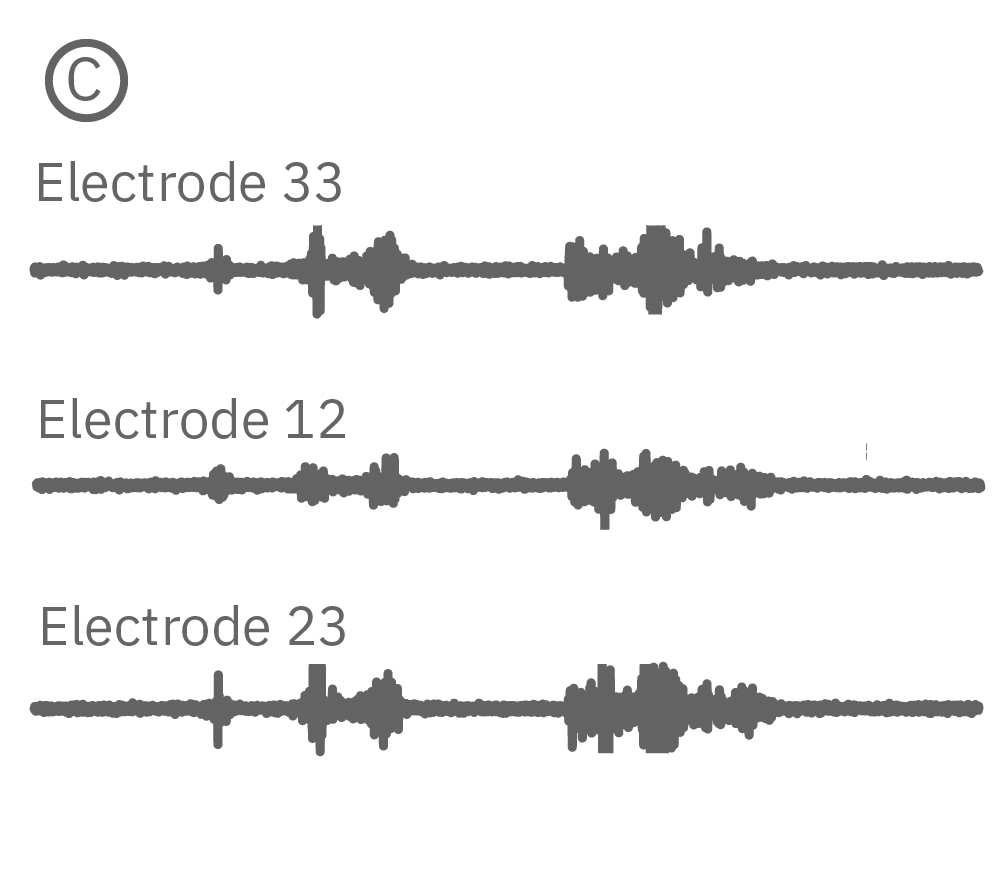 Continuous data recorded from 3 electrodes in one well.