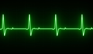 cardiac electrophysiology on microelectrode array