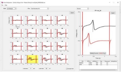 cardiac module tool