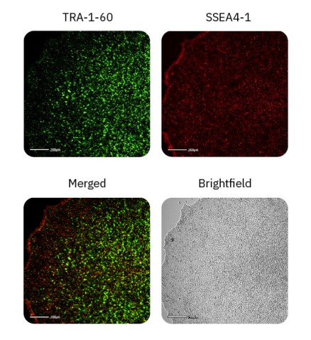 Fluorescent images of iPSC pluripotent markers TRA-1-60 and SSEA4-1 at Day 4