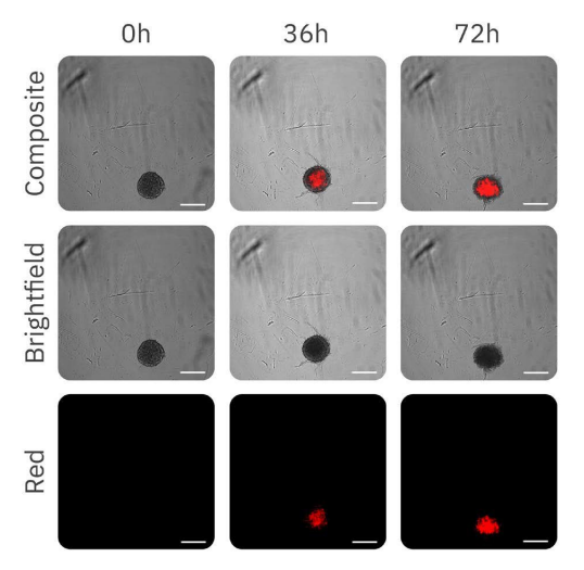 Figure 3: Fluorescence images of spheroids over time