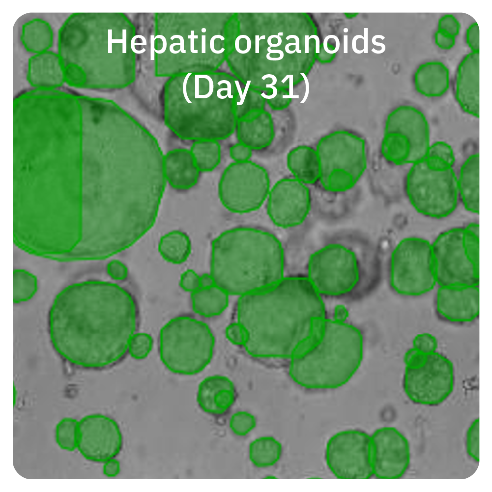 Hepatic organoids on Day 31