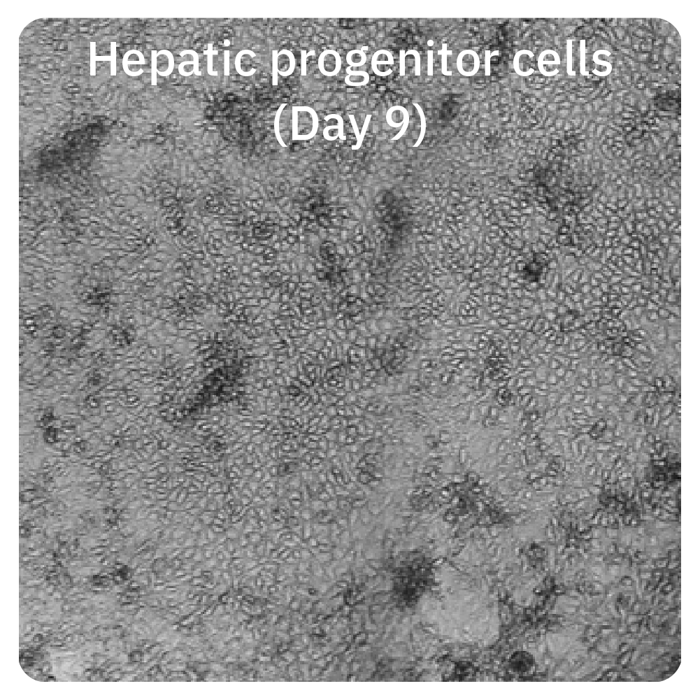 Hepatic progenitor cells on Day 9
