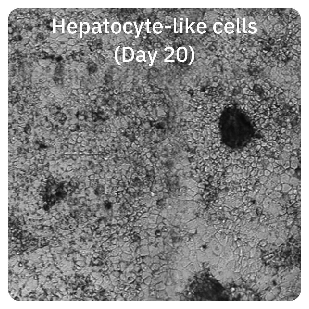 Hepatocyte-like cells on Day 20