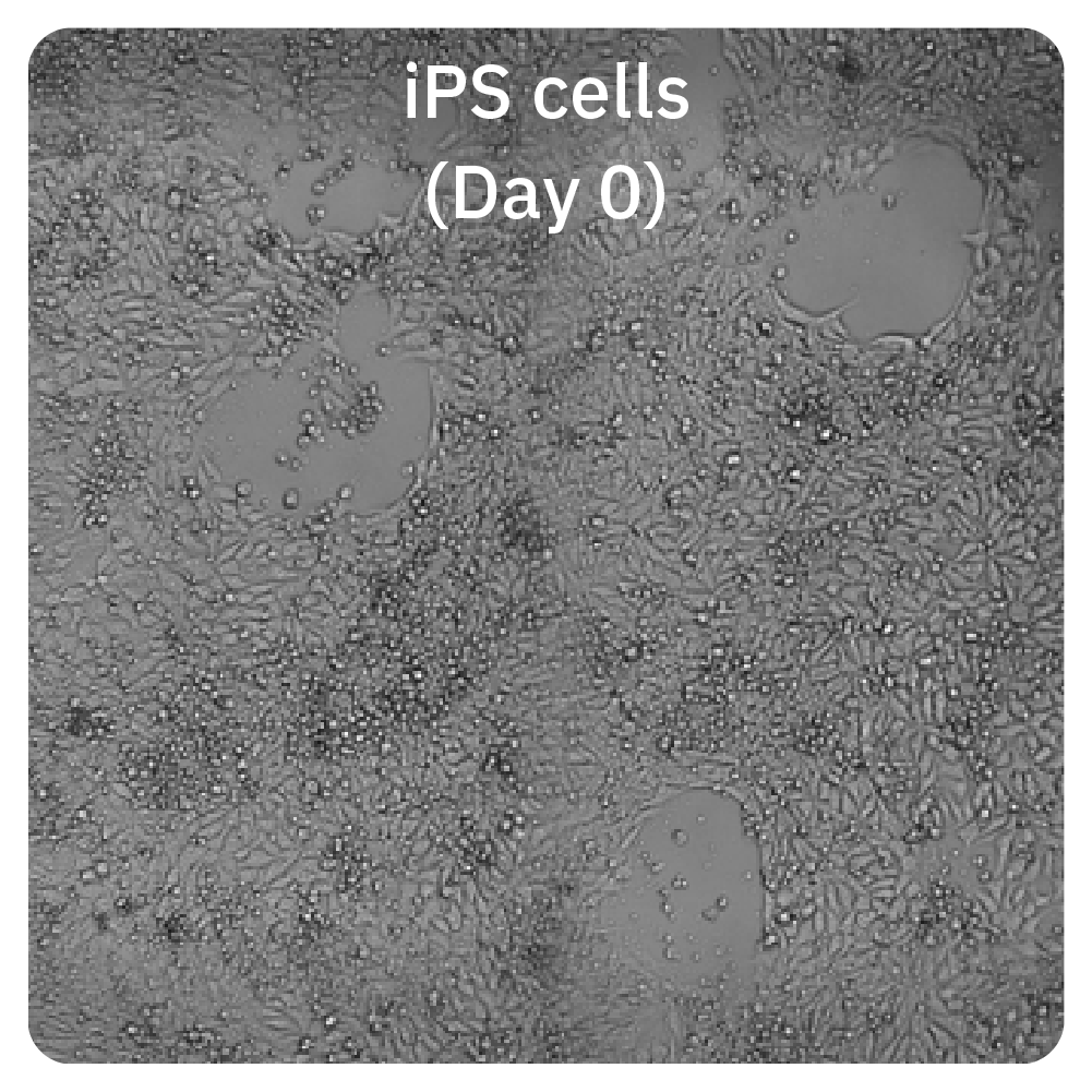 iPS Cells on Day 0