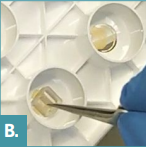 neural co-culture cytoview MEA plate with ibidi insert