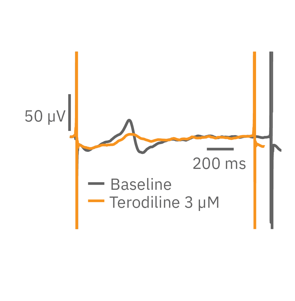 Terodiline T-wave