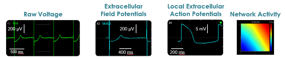 From raw voltage to network activity