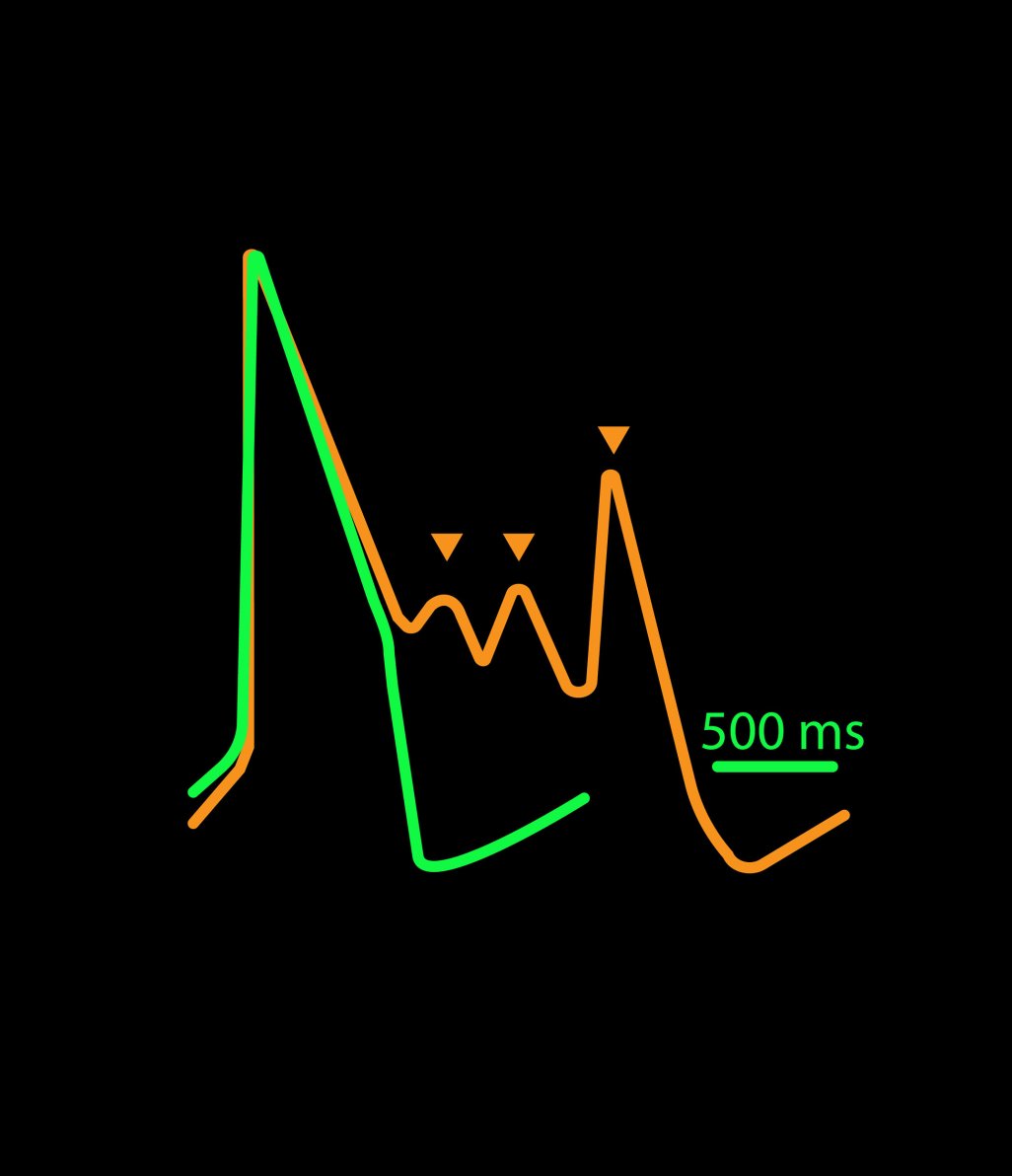 Cardiotoxicity traces