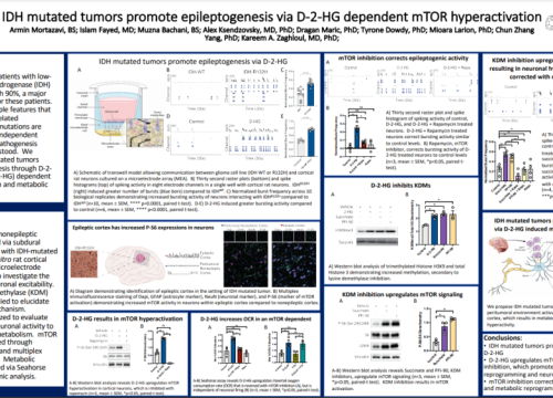 sfN 2021 Poster on brain turmors and epilepsy mechanism recorded on multiwell MEA system
